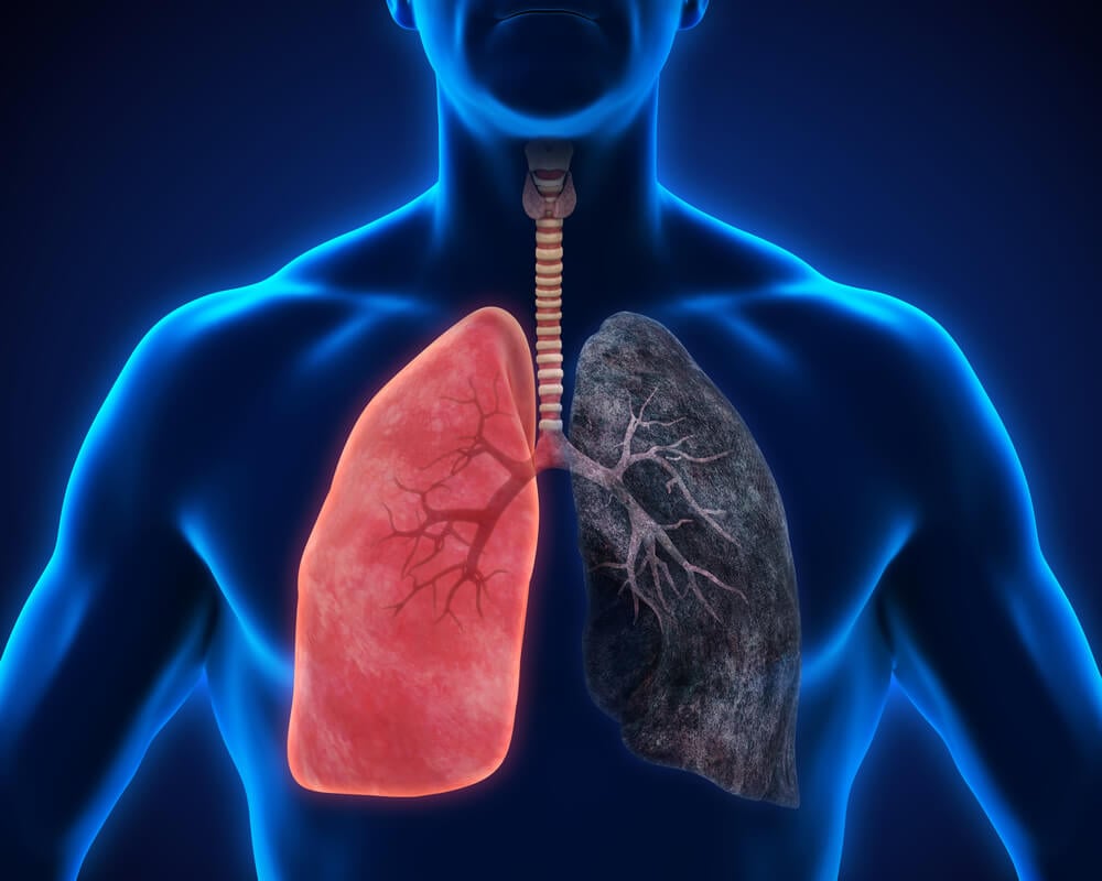 Los Pulmones