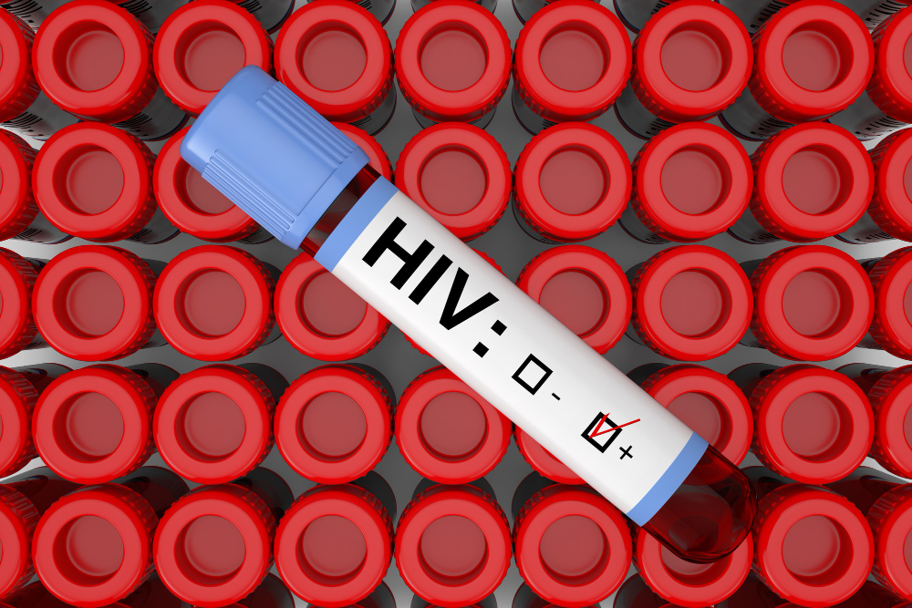 VIH/SIDA